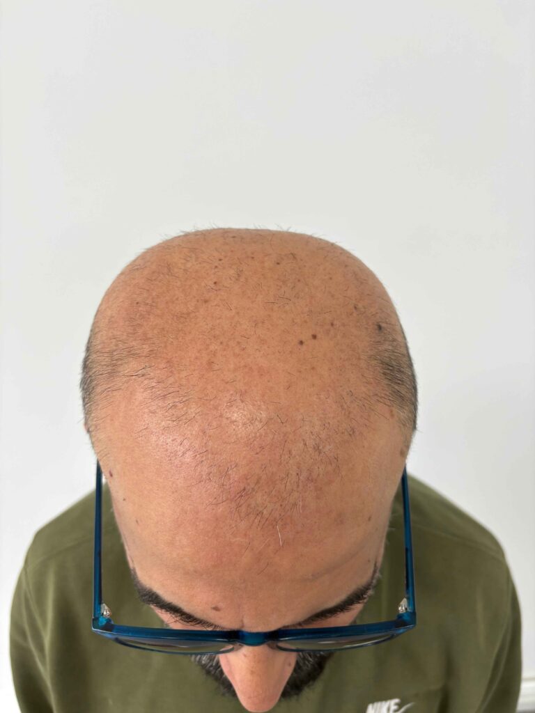 Hair Tattoo Limburg